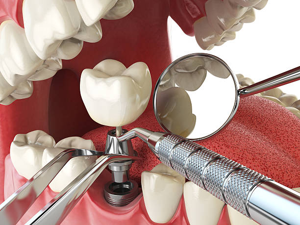 Best Weekend Emergency Dentist in Sully Square, VA